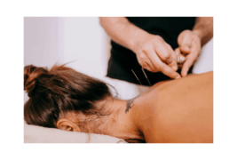 Acupuncture